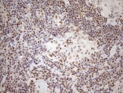 MGMT Monoclonal Antibody (OTI6C4), TrueMAB , OriGene 100 μL; Unconjugated:Antibodies,