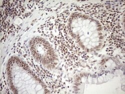 MGMT Monoclonal Antibody (OTI6C4), TrueMAB , OriGene 100 μL; Unconjugated:Antibodies,