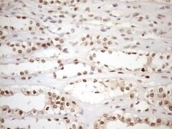 MGMT Monoclonal Antibody (OTI6C4), TrueMAB , OriGene 100 μL; Unconjugated:Antibodies,