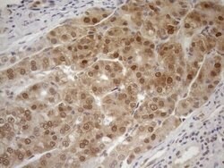 MGMT Monoclonal Antibody (OTI6C4), TrueMAB , OriGene 100 μL; Unconjugated:Antibodies,