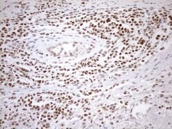 MGMT Mouse anti-Human, Clone: OTI5A7, lyophilized, TrueMAB 100 &mu;g; Unconjugated:Antibodies,