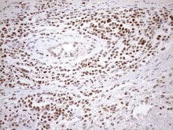 MGMT Monoclonal Antibody (OTI5A7), TrueMAB , OriGene 30 &mu;L; Unconjugated:Antibodies,