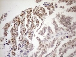 MGMT Mouse anti-Human, Clone: OTI5A7, lyophilized, TrueMAB 100 &mu;g; Unconjugated:Antibodies,