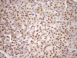 MGMT Mouse anti-Human, Clone: OTI5A7, lyophilized, TrueMAB 100 &mu;g; Unconjugated:Antibodies,
