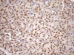 MGMT Monoclonal Antibody (OTI5A7), TrueMAB , OriGene 30 &mu;L; Unconjugated:Antibodies,