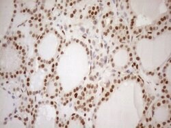 MGMT Mouse anti-Human, Clone: OTI5A7, lyophilized, TrueMAB 100 &mu;g; Unconjugated:Antibodies,