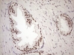 MGMT Mouse anti-Human, Clone: OTI5A7, lyophilized, TrueMAB 100 &mu;g; Unconjugated:Antibodies,
