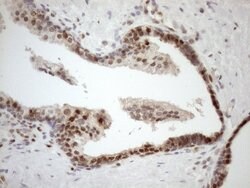 MGMT Mouse anti-Human, Clone: OTI5A7, lyophilized, TrueMAB 100 &mu;g; Unconjugated:Antibodies,