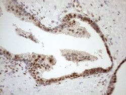 MGMT Monoclonal Antibody (OTI5A7), TrueMAB , OriGene 30 &mu;L; Unconjugated:Antibodies,