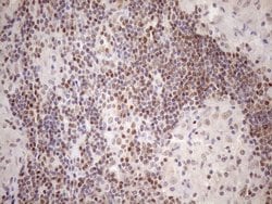 MGMT Monoclonal Antibody (OTI5A7), TrueMAB , OriGene 30 &mu;L; Unconjugated:Antibodies,