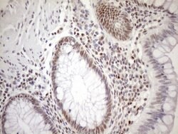 MGMT Mouse anti-Human, Clone: OTI5A7, lyophilized, TrueMAB 100 &mu;g; Unconjugated:Antibodies,