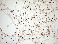 MGMT Mouse anti-Human, Clone: OTI5A7, lyophilized, TrueMAB 100 &mu;g; Unconjugated:Antibodies,