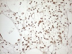 MGMT Monoclonal Antibody (OTI5A7), TrueMAB , OriGene 30 &mu;L; Unconjugated:Antibodies,
