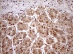 MGMT Mouse anti-Human, Clone: OTI5A7, lyophilized, TrueMAB 100 &mu;g; Unconjugated:Antibodies,