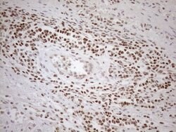 MGMT Mouse anti-Human, Clone: OTI2E2, lyophilized, TrueMAB 100 &mu;g; Unconjugated:Antibodies,