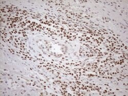 MGMT Monoclonal Antibody (OTI2E2), TrueMAB , OriGene 100 &mu;L; Unconjugated:Antibodies,