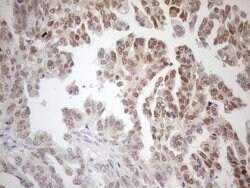 MGMT Mouse anti-Human, Clone: OTI2E2, lyophilized, TrueMAB 100 &mu;g; Unconjugated:Antibodies,