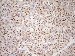 MGMT Mouse anti-Human, Clone: OTI2E2, lyophilized, TrueMAB 100 &mu;g; Unconjugated:Antibodies,