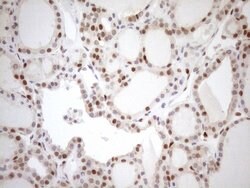MGMT Mouse anti-Human, Clone: OTI2E2, lyophilized, TrueMAB 100 &mu;g; Unconjugated:Antibodies,