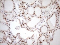 MGMT Monoclonal Antibody (OTI2E2), TrueMAB , OriGene 100 &mu;L; Unconjugated:Antibodies,