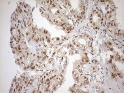 MGMT Mouse anti-Human, Clone: OTI2E2, lyophilized, TrueMAB 100 &mu;g; Unconjugated:Antibodies,