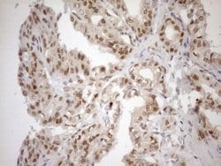 MGMT Monoclonal Antibody (OTI2E2), TrueMAB , OriGene 100 &mu;L; Unconjugated:Antibodies,