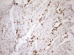 MGMT Mouse anti-Human, Clone: OTI2E2, lyophilized, TrueMAB 100 &mu;g; Unconjugated:Antibodies,