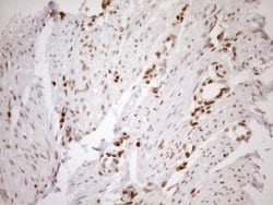 MGMT Monoclonal Antibody (OTI2E2), TrueMAB , OriGene 100 &mu;L; Unconjugated:Antibodies,