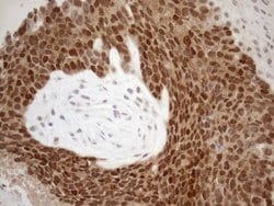 MGMT Monoclonal Antibody (OTI2E2), TrueMAB , OriGene 100 &mu;L; Unconjugated:Antibodies,