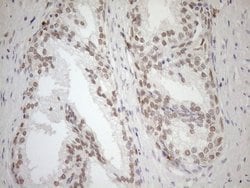 MGMT Mouse anti-Human, Clone: OTI2E2, lyophilized, TrueMAB 100 &mu;g; Unconjugated:Antibodies,