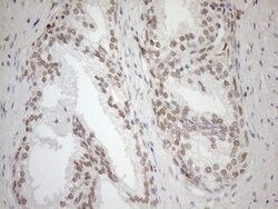 MGMT Monoclonal Antibody (OTI2E2), TrueMAB , OriGene 100 &mu;L; Unconjugated:Antibodies,