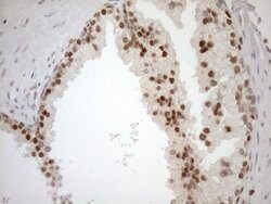 MGMT Mouse anti-Human, Clone: OTI2E2, lyophilized, TrueMAB 100 &mu;g; Unconjugated:Antibodies,