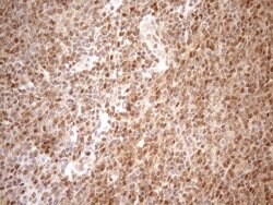MGMT Mouse anti-Human, Clone: OTI2E2, lyophilized, TrueMAB 100 &mu;g; Unconjugated:Antibodies,
