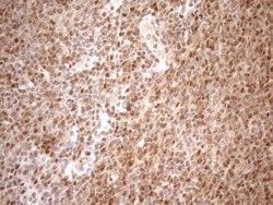MGMT Monoclonal Antibody (OTI2E2), TrueMAB , OriGene 100 &mu;L; Unconjugated:Antibodies,
