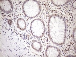 MGMT Mouse anti-Human, Clone: OTI2E2, lyophilized, TrueMAB 100 &mu;g; Unconjugated:Antibodies,