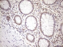 MGMT Monoclonal Antibody (OTI2E2), TrueMAB , OriGene 100 &mu;L; Unconjugated:Antibodies,