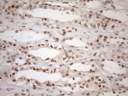 MGMT Mouse anti-Human, Clone: OTI2E2, lyophilized, TrueMAB 100 &mu;g; Unconjugated:Antibodies,