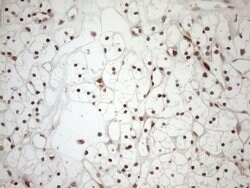 MGMT Mouse anti-Human, Clone: OTI2E2, lyophilized, TrueMAB 100 &mu;g; Unconjugated:Antibodies,