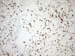 MGMT Monoclonal Antibody (OTI2E2), TrueMAB , OriGene 100 &mu;L; Unconjugated:Antibodies,