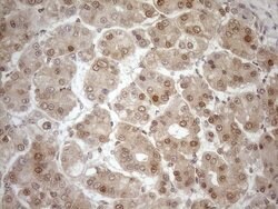 MGMT Mouse anti-Human, Clone: OTI2E2, lyophilized, TrueMAB 100 &mu;g; Unconjugated:Antibodies,