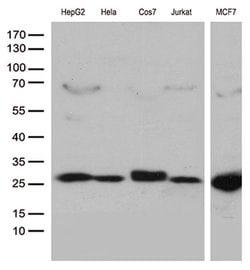 MGMT Monoclonal Antibody (OTI4E6), TrueMAB , OriGene 100 &mu;L; Unconjugated:Antibodies,