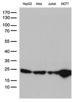 MGMT Monoclonal Antibody (OTI6C4), TrueMAB , OriGene 100 μL; Unconjugated:Antibodies,