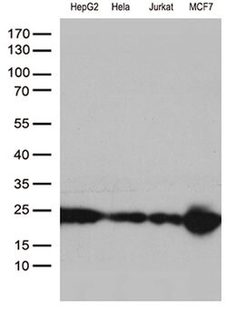 MGMT Mouse anti-Human, Clone: OTI5A7, lyophilized, TrueMAB 100 &mu;g; Unconjugated:Antibodies,