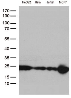 MGMT Monoclonal Antibody (OTI5A7), TrueMAB , OriGene 30 &mu;L; Unconjugated:Antibodies,
