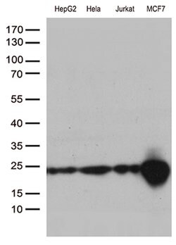 MGMT Mouse anti-Human, Clone: OTI2E2, lyophilized, TrueMAB 100 &mu;g; Unconjugated:Antibodies,