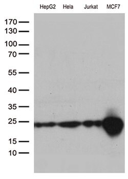 MGMT Monoclonal Antibody (OTI2E2), TrueMAB , OriGene 100 &mu;L; Unconjugated:Antibodies,