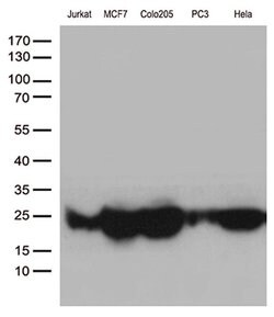 MGMT Monoclonal Antibody (OTI17H4), TrueMAB , OriGene 100 &mu;L; Unconjugated:Antibodies,