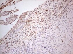 MGP Mouse anti-Human, Clone: OTI11G6, lyophilized, TrueMAB 100 &mu;g; Unconjugated:Antibodies,