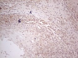 MGP Mouse anti-Human, Clone: OTI11G6, lyophilized, TrueMAB 100 &mu;g; Unconjugated:Antibodies,