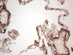 MGP Mouse anti-Human, Clone: OTI11G6, lyophilized, TrueMAB 100 &mu;g; Unconjugated:Antibodies,